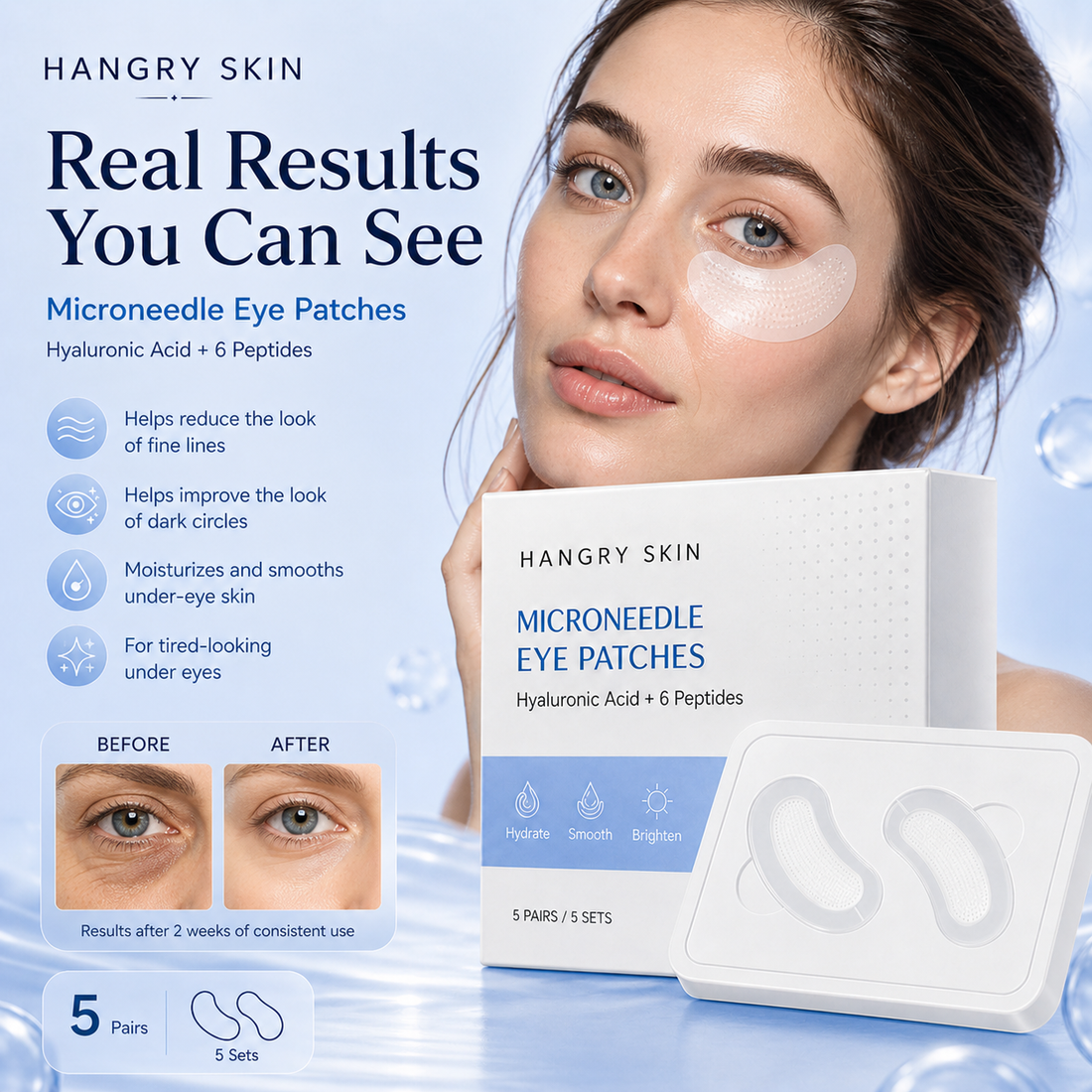 HANGRY SKIN™ MICRONEEDLE EYE PATCHES